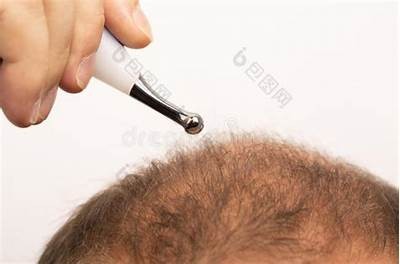 成人脱发方法视频教程免费观看
